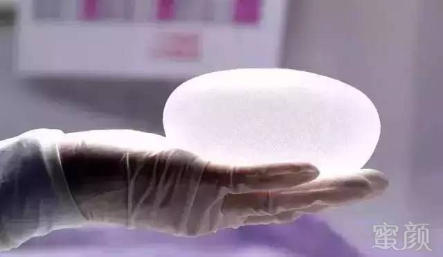 https://img.miyanlife.com/mnt/timg/171003/1100016423-2.jpg