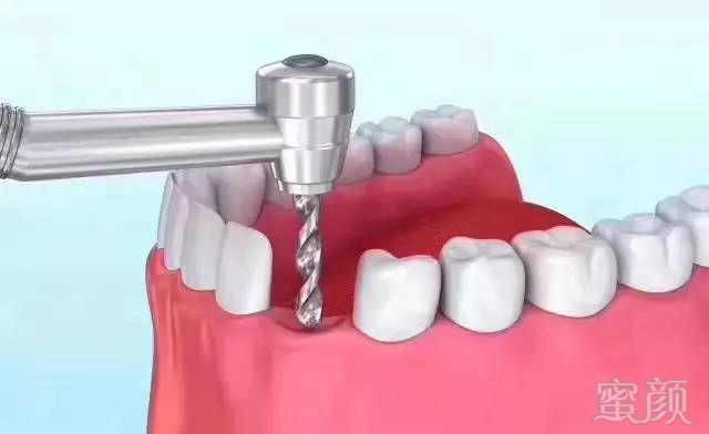 https://img.miyanlife.com/mnt/timg/171004/0926405N0-3.jpg