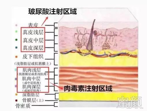 案例图片