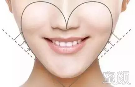 https://img.miyanlife.com/mnt/timg/171007/16333QN3-5.jpg