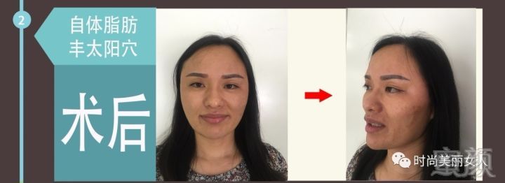 https://img.miyanlife.com/mnt/timg/171007/1F034J13-5.jpg