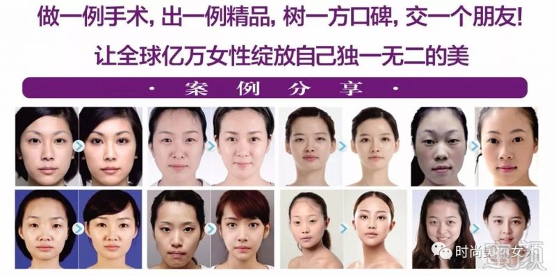 https://img.miyanlife.com/mnt/timg/171007/1F03L0U-15.jpg