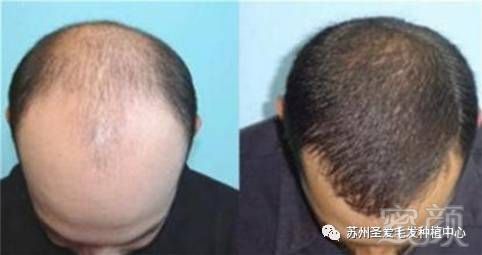 https://img.miyanlife.com/mnt/timg/171009/12210Lc6-6.jpg