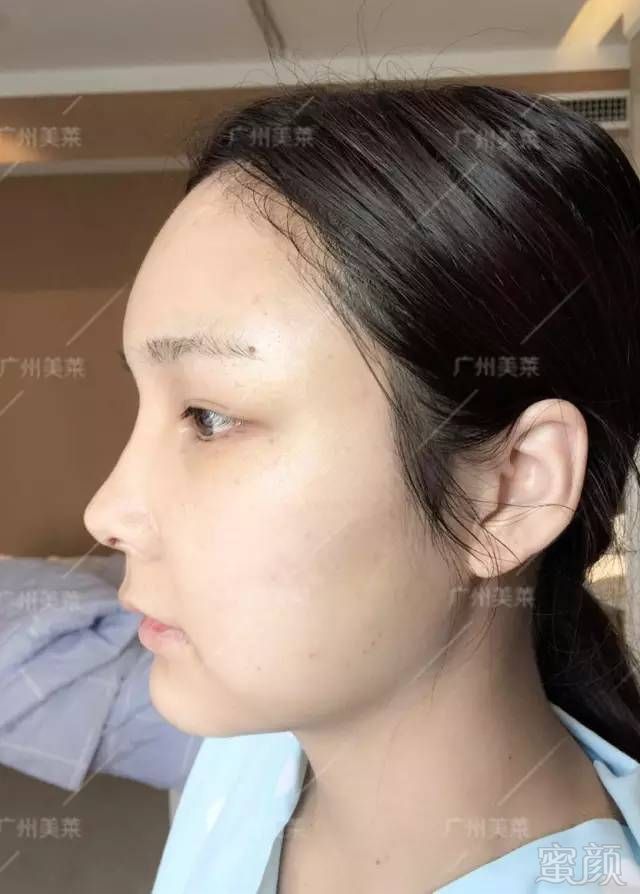 https://img.miyanlife.com/mnt/timg/171010/1055102T6-6.jpg