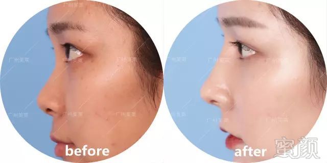 https://img.miyanlife.com/mnt/timg/171010/105511E00-9.jpg