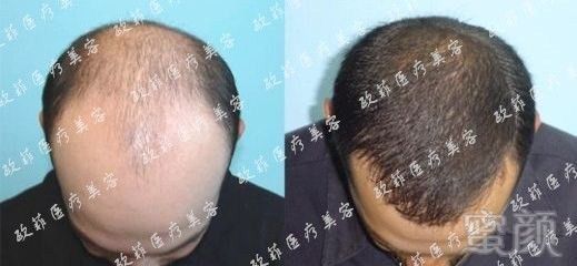 https://img.miyanlife.com/mnt/timg/171010/105G21538-14.jpg