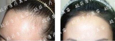 https://img.miyanlife.com/mnt/timg/171010/105G26206-13.jpg
