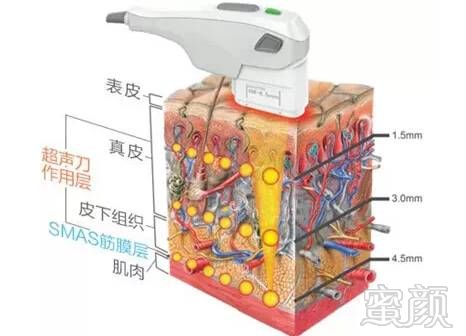 案例图片