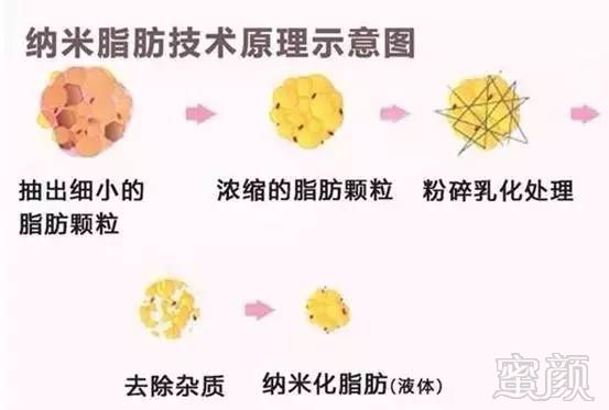 https://img.miyanlife.com/mnt/timg/171010/1240311592-0.jpg