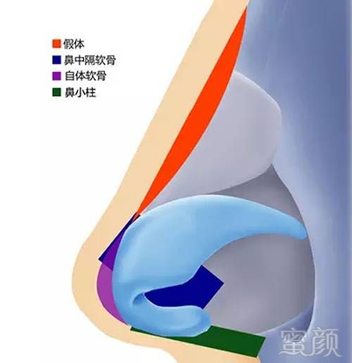 案例图片