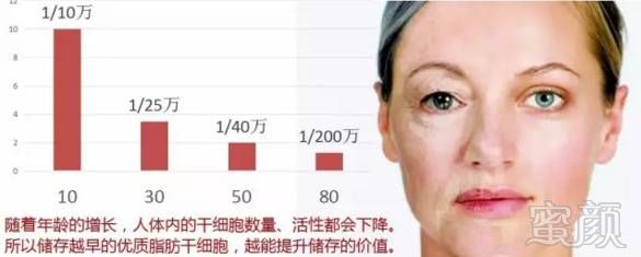 https://img.miyanlife.com/mnt/timg/171011/1342453107-2.jpg