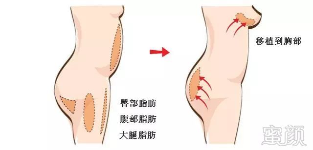https://img.miyanlife.com/mnt/timg/171011/134342G37-7.jpg