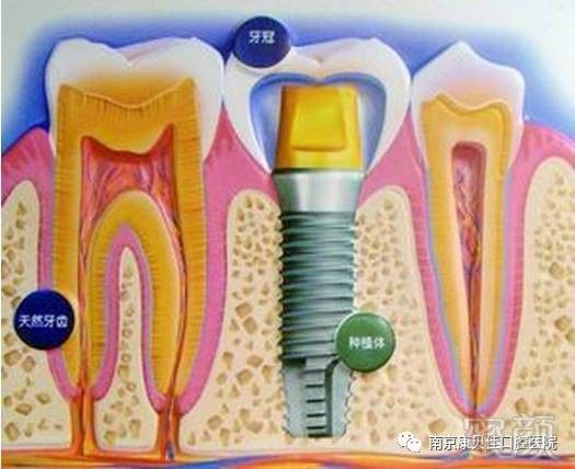 案例图片