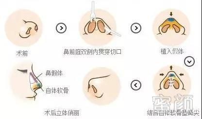 https://img.miyanlife.com/mnt/timg/171012/12030960F-5.jpg