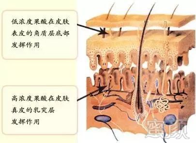 案例图片