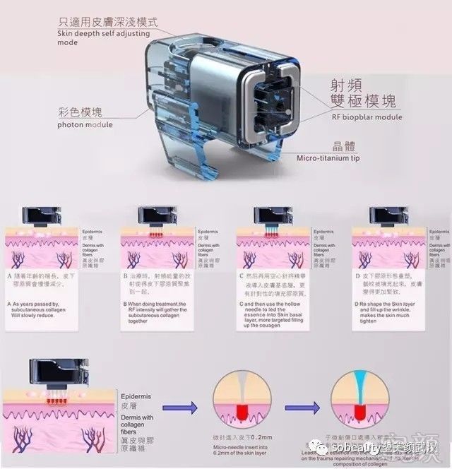 案例图片