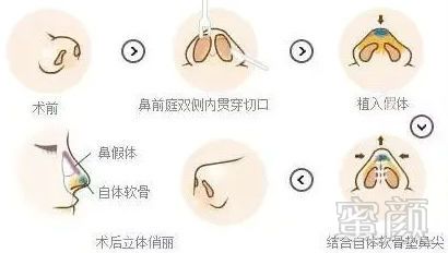 https://img.miyanlife.com/mnt/timg/171013/1032351542-5.jpg