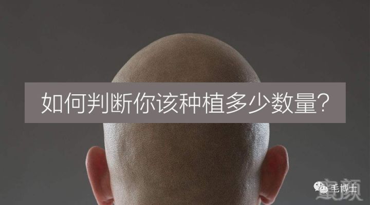 https://img.miyanlife.com/mnt/timg/171013/1254302W2-0.jpg