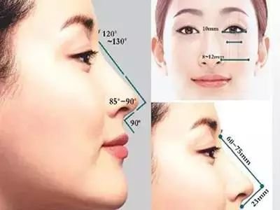 https://img.miyanlife.com/mnt/timg/171013/1516254101-1.jpg