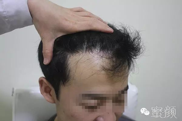https://img.miyanlife.com/mnt/timg/171014/10402645L-9.jpg