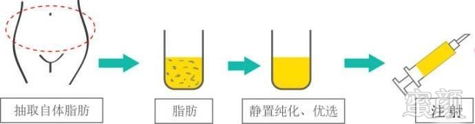 https://img.miyanlife.com/mnt/timg/171014/11414J558-2.jpg