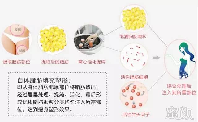 https://img.miyanlife.com/mnt/timg/171014/132GI0D-4.jpg