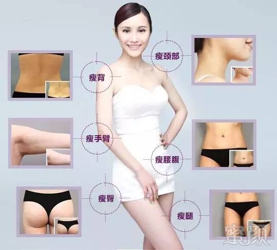 https://img.miyanlife.com/mnt/timg/171014/132GK158-2.jpg