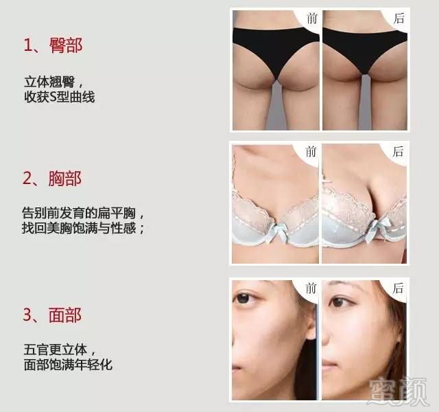 https://img.miyanlife.com/mnt/timg/171014/132GVS7-5.jpg