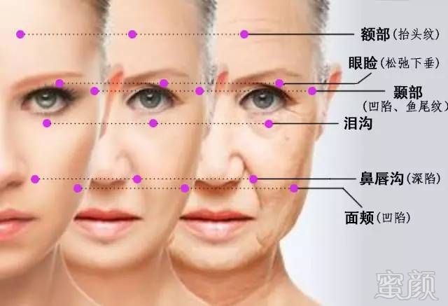 https://img.miyanlife.com/mnt/timg/171014/132GW0U-6.jpg