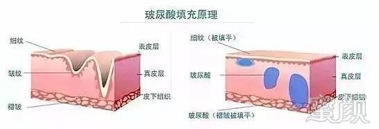 https://img.miyanlife.com/mnt/timg/171014/132K011c-3.jpg