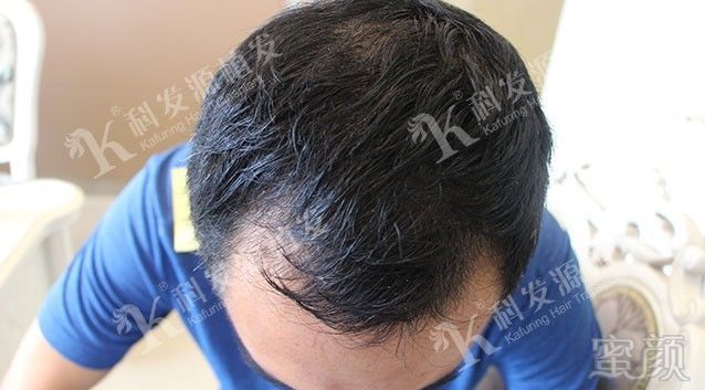 https://img.miyanlife.com/mnt/timg/171015/132A91J8-8.jpg