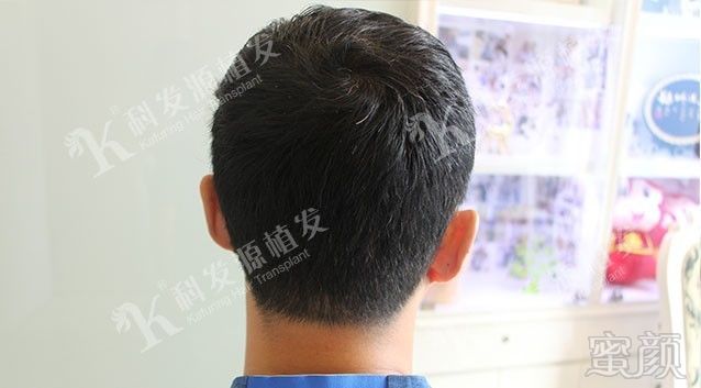 https://img.miyanlife.com/mnt/timg/171015/132A944S-9.jpg