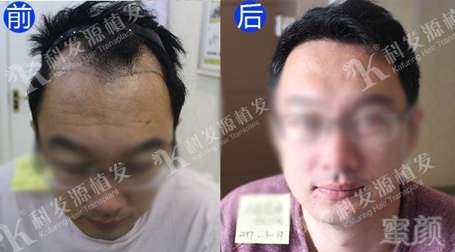 https://img.miyanlife.com/mnt/timg/171015/132AH949-0.jpg