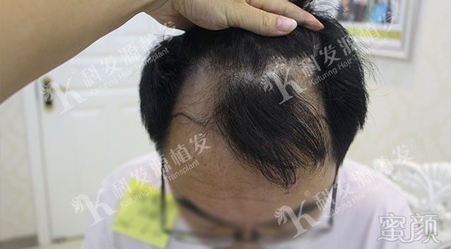 https://img.miyanlife.com/mnt/timg/171015/132AJX8-1.jpg