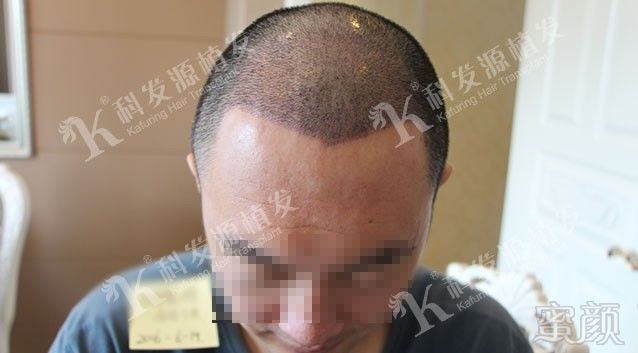 https://img.miyanlife.com/mnt/timg/171015/132AR112-6.jpg