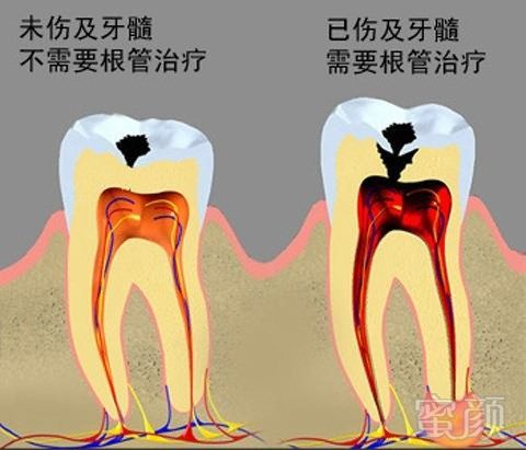 案例图片