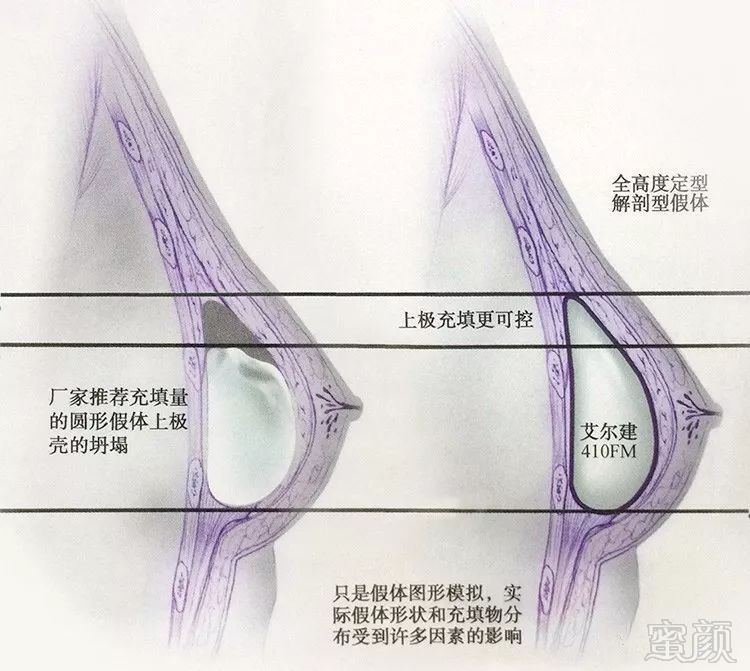 案例图片