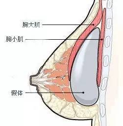 案例图片