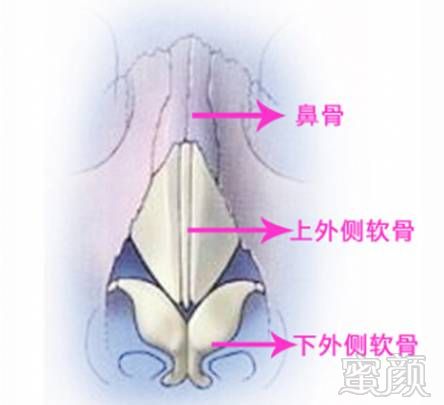 案例图片