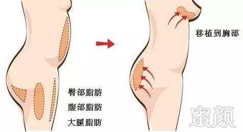 https://img.miyanlife.com/mnt/timg/171016/13064060U-6.jpg