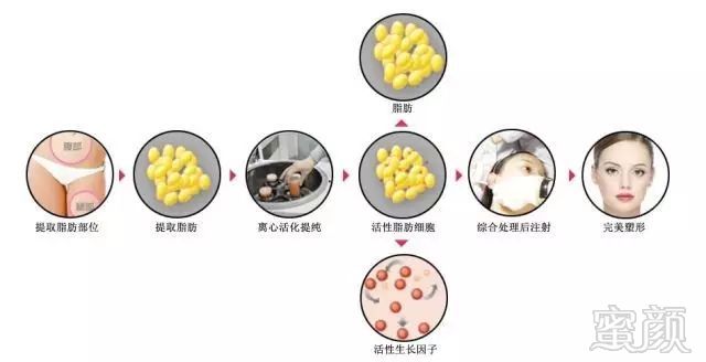 https://img.miyanlife.com/mnt/timg/171016/1306416041-7.jpg