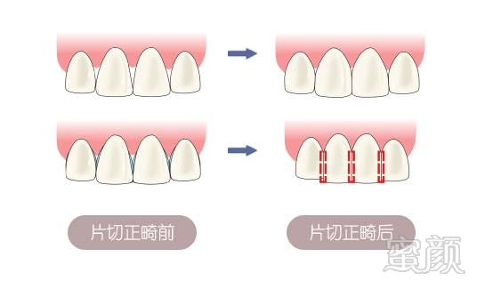 案例图片