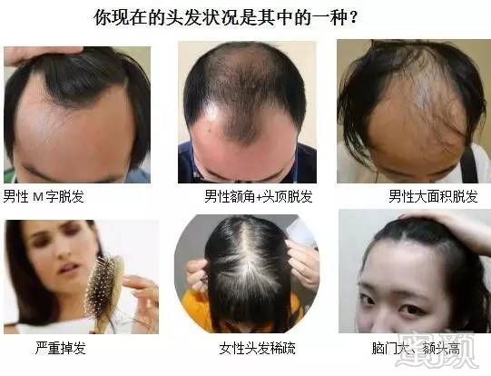 https://img.miyanlife.com/mnt/timg/171018/10364IP2-6.jpg