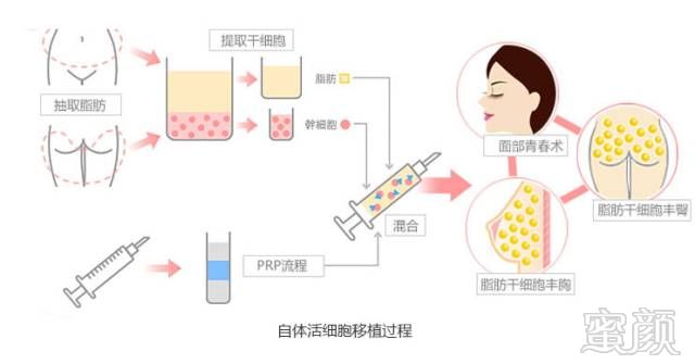 https://img.miyanlife.com/mnt/timg/171018/115HQ320-2.jpg