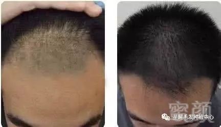 https://img.miyanlife.com/mnt/timg/171019/1122545452-1.jpg