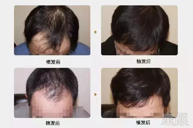 https://img.miyanlife.com/mnt/timg/171019/112254B12-0.jpg