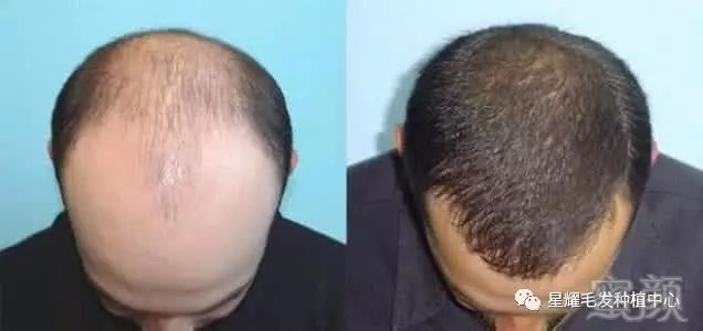 https://img.miyanlife.com/mnt/timg/171019/1122551N1-3.jpg