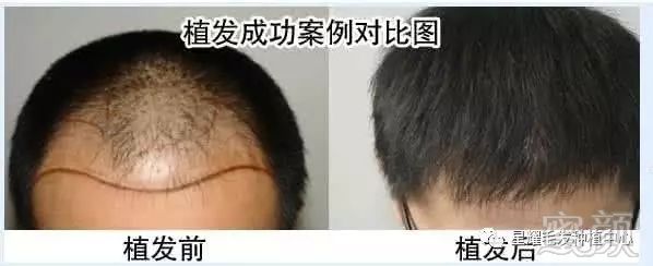 https://img.miyanlife.com/mnt/timg/171019/11225T5O-4.jpg