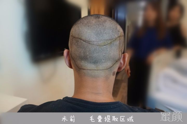 https://img.miyanlife.com/mnt/timg/171019/11233CB2-1.jpg