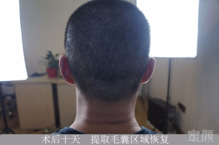 https://img.miyanlife.com/mnt/timg/171019/11233L624-3.jpg